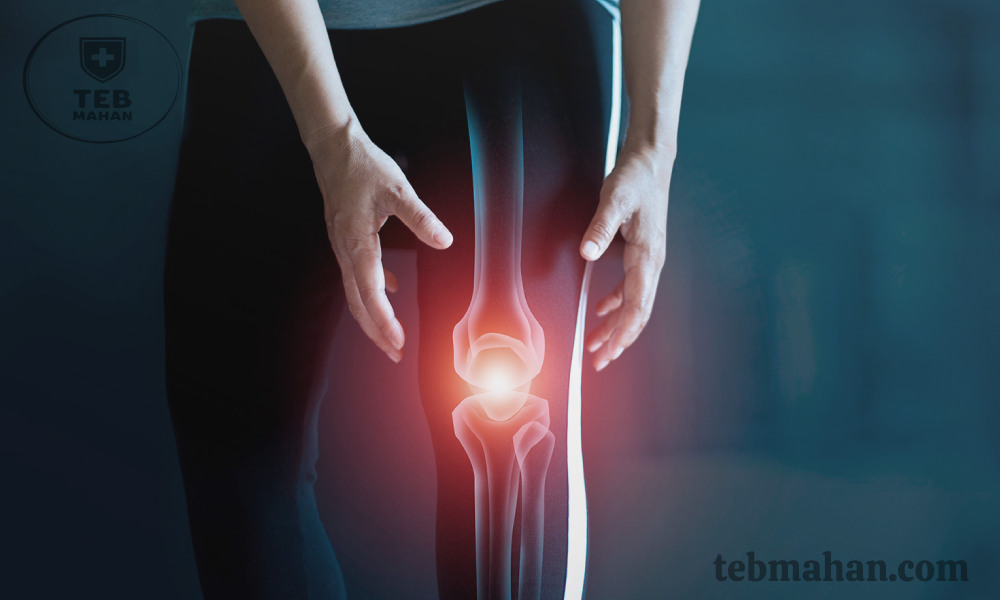 تفاوت علائم آرتروز با دردهای معمول زانو