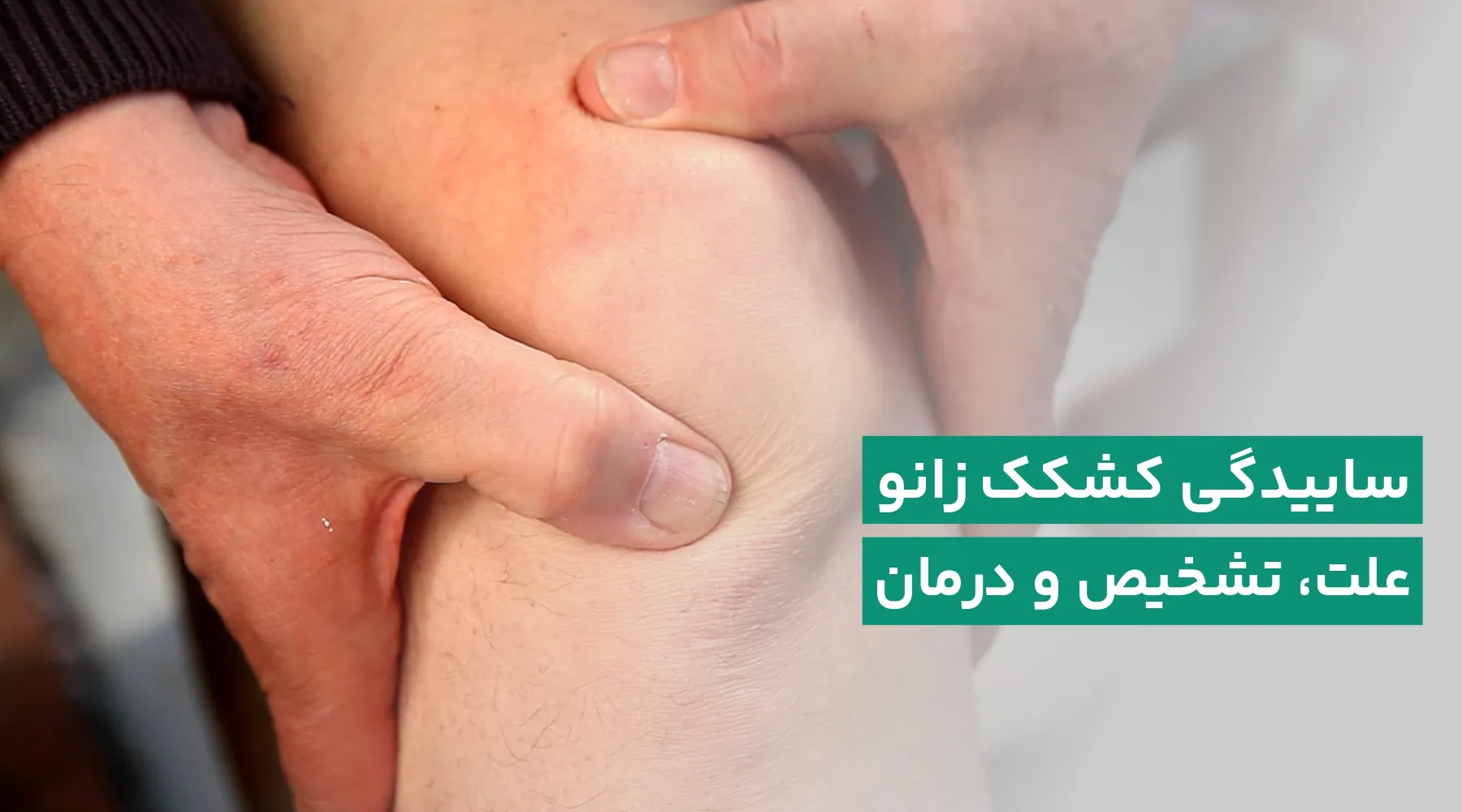 ساییدگی کشکک زانو