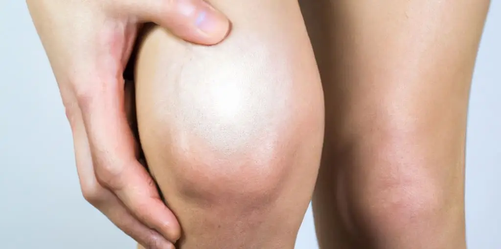 مینیسک زانو