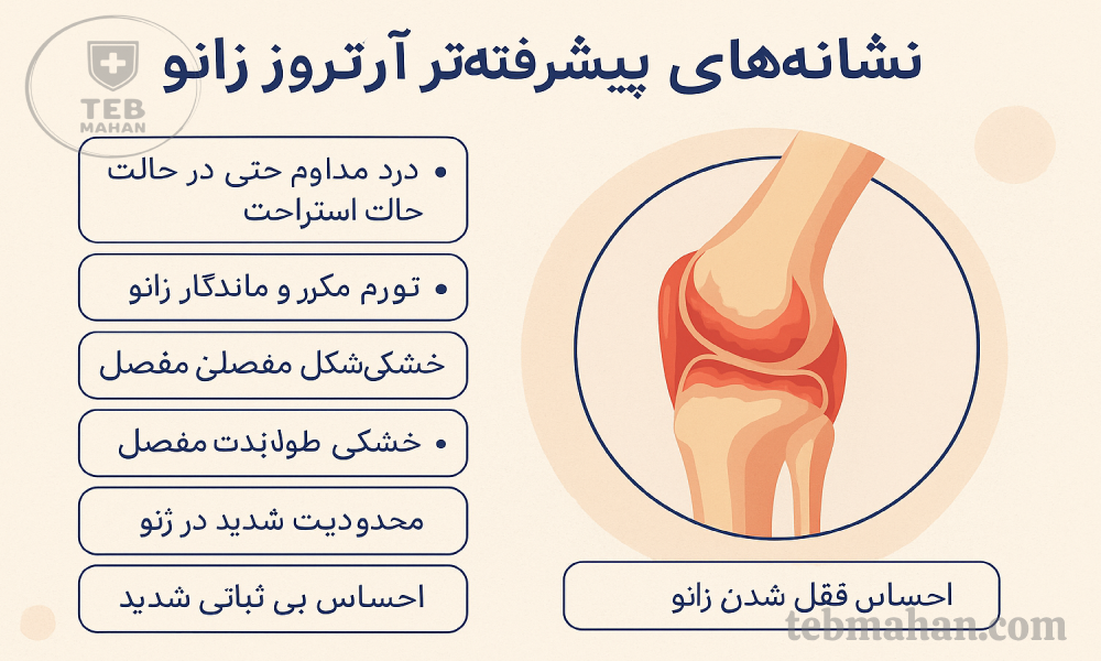 علائم آرتروز؛ آرتروز چیست و چگونه درمان می شود؟