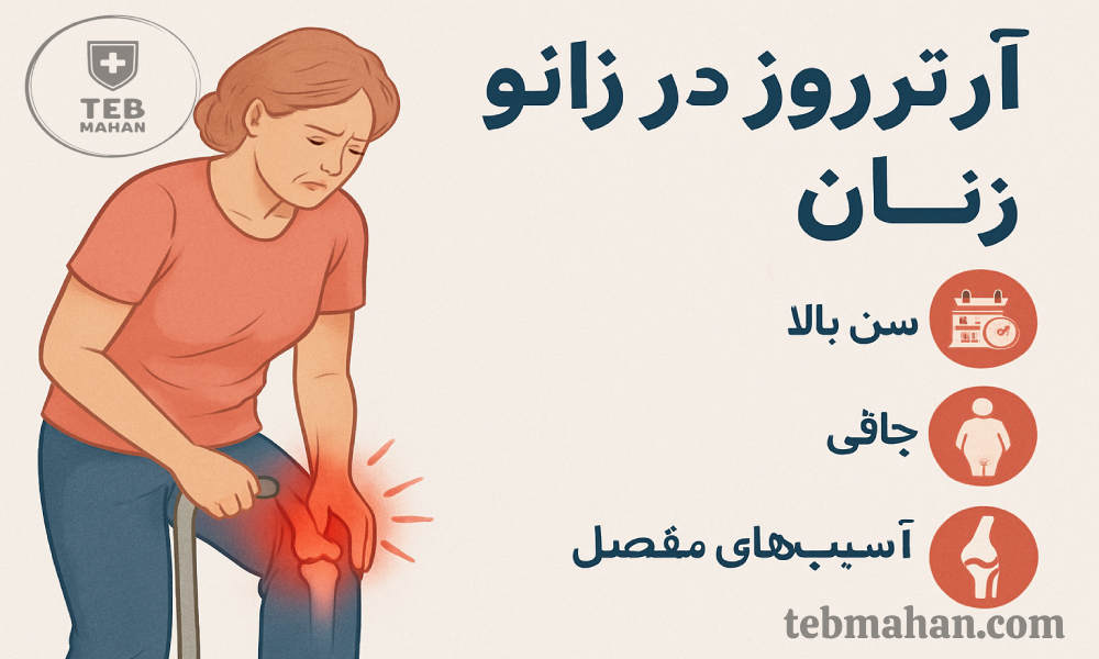 علت آرتروز زانو در زنان