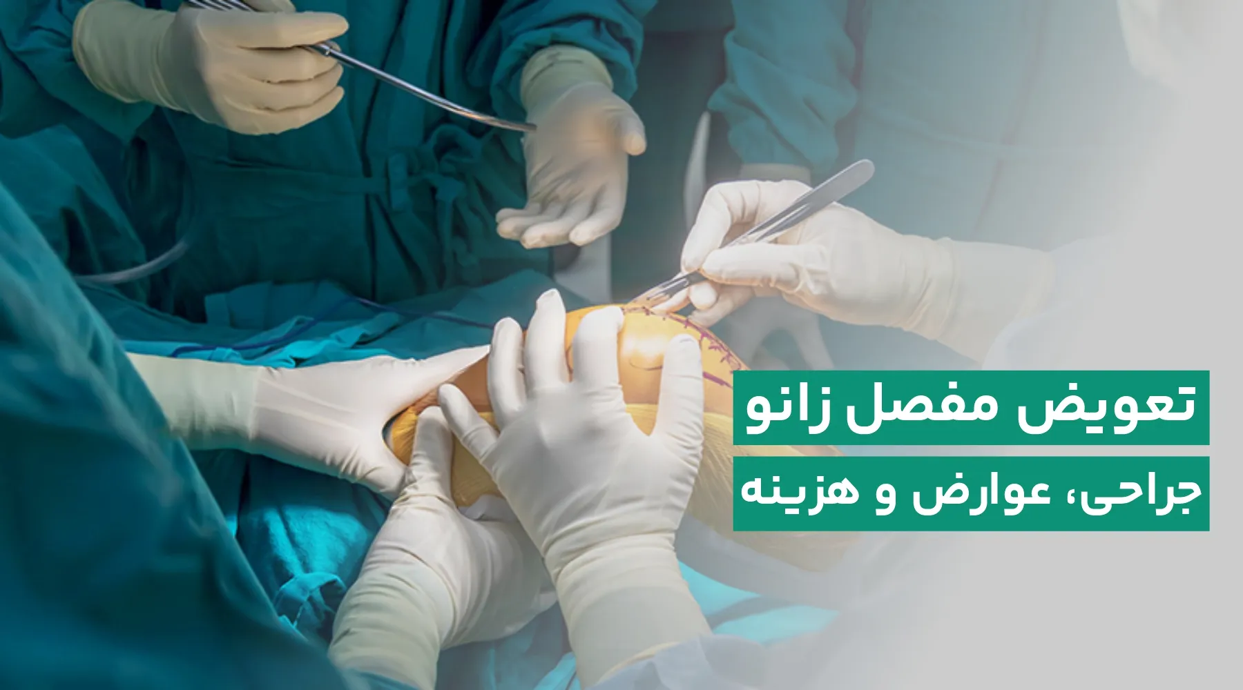 عمل تعویض مفصل زانو چیست؟