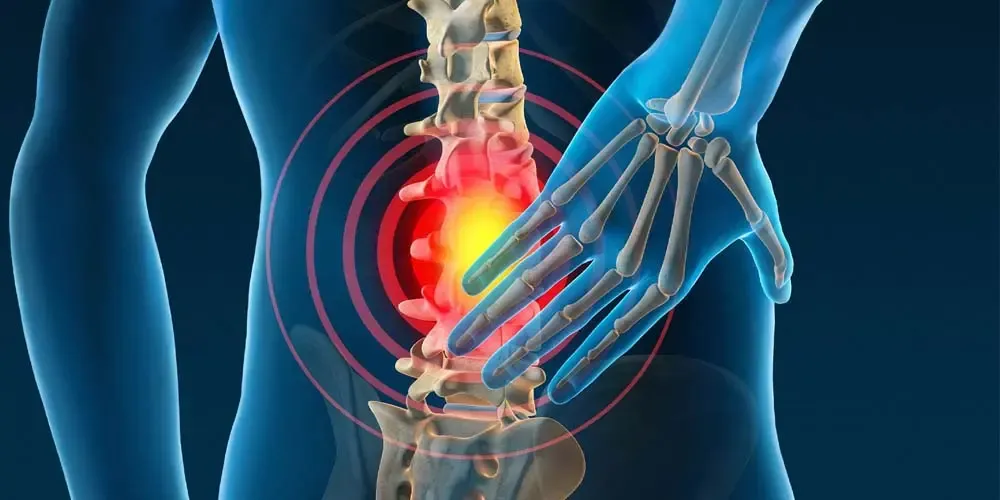 درمان درد سیاتیک