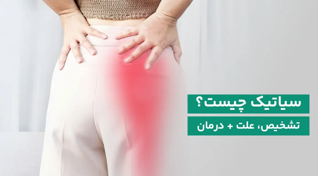 سیاتیک چیست